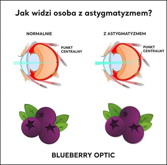 Astygmatyzm: Plusy, minusy i cylinder? Zrozum swoją wadę!