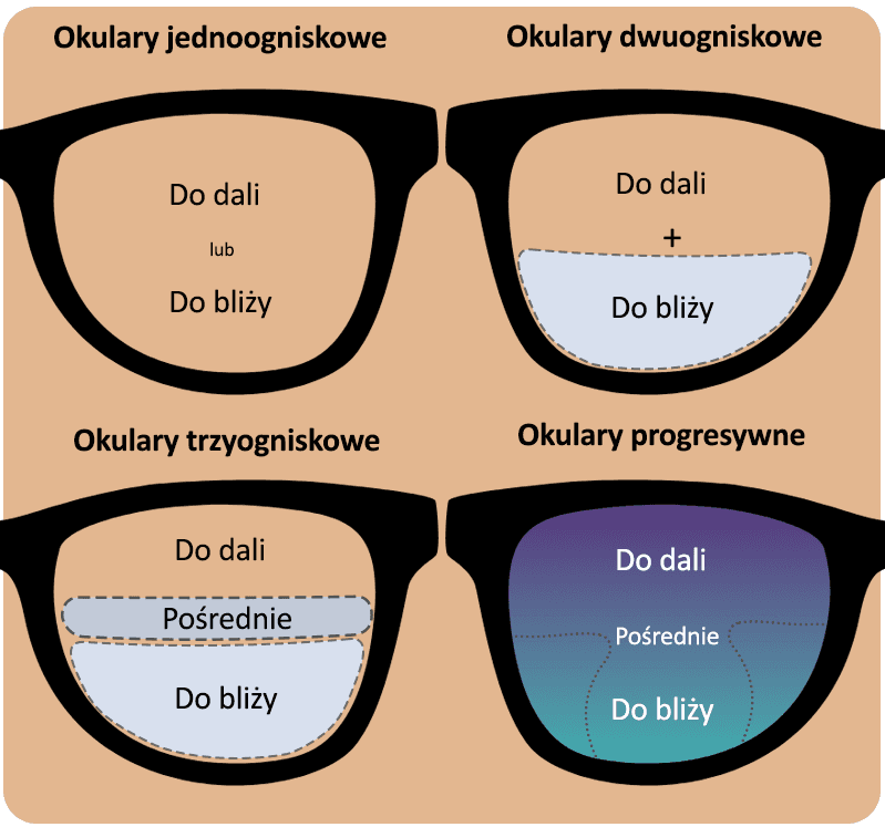 Oprawki do progresów: Wybierz idealne i zapomnij o problemach!
